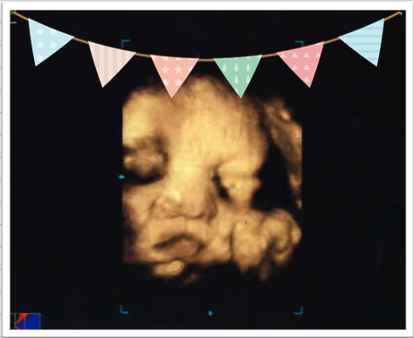 お腹の赤ちゃん写真館 18 8 18 ニュース トピックス 小川クリニック 戸塚駅 東戸塚駅 産婦人科 小児科 内科